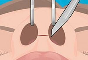 Nasal Care Medical Simulator